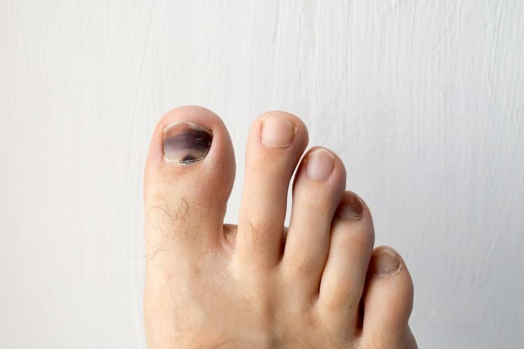 Tanpa Disadari, Ini Kesalahan Perawatan Kuku yang Sering Dilakukan Banyak Orang