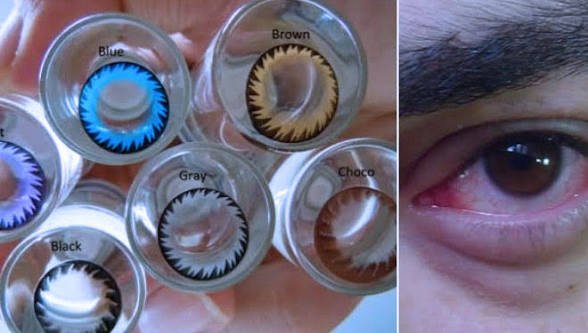 Di Balik Mata Indah: Dampak Penggunaan Softlens yang Sering Tidak Disadari