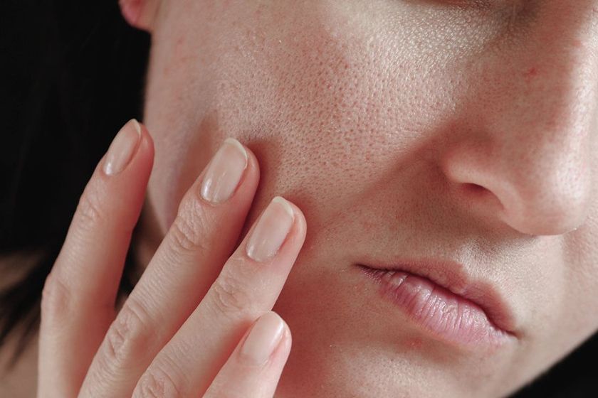Sudah Pakai Moisturizer tapi Kulit Masih Kering? Ini 5 Penyebab yang Sering Tidak Disadari